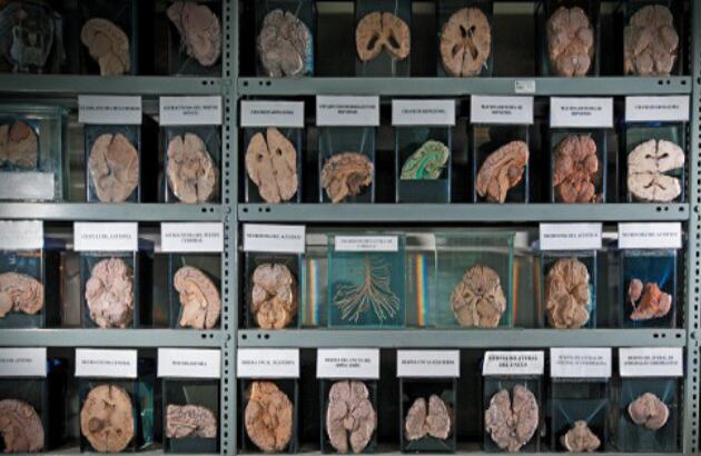 El Museo del Cerebro de Lima posee más de 3.000 órganos. Exhiben 300 a la vez. Foto:revistalaverde.pe