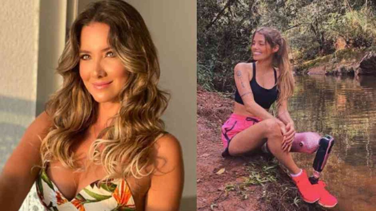 La modelo ha buscado ayudar a quienes tienen una discapacidad física y no cuentan con los recursos económicos para adquirir una prótesis o iniciar un proceso de rehabilitación.