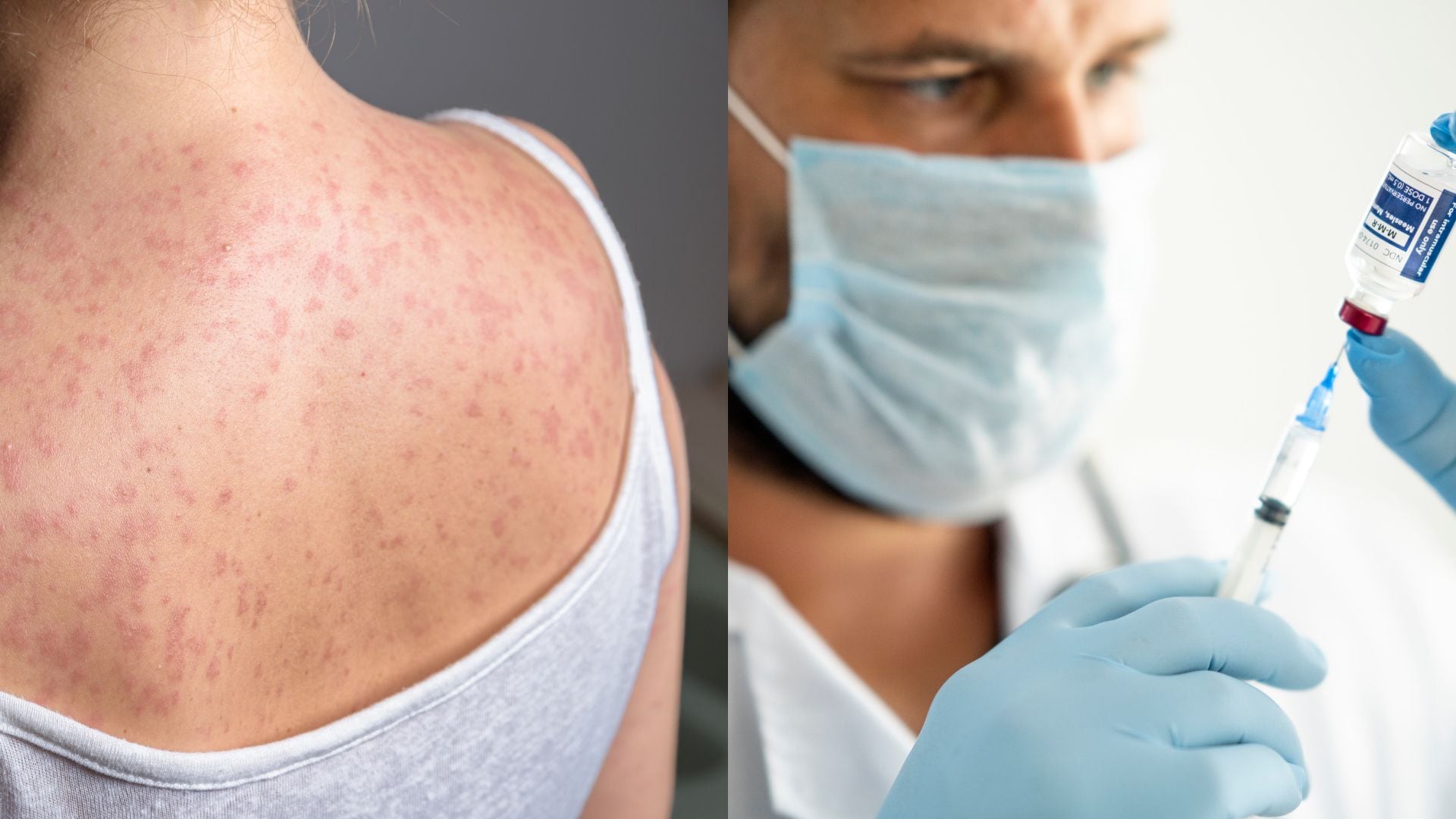 La Secretaría Distrital de Salud puso en marcha un plan preventivo con 44.700 dosis disponibles de vacuna triple viral y SR