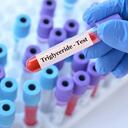 Los triglicéridos son lípidos que en exceso pueden afectar la salud cardiovascular.