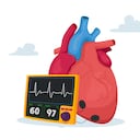 El colesterol elevado puede taponar las arterias.