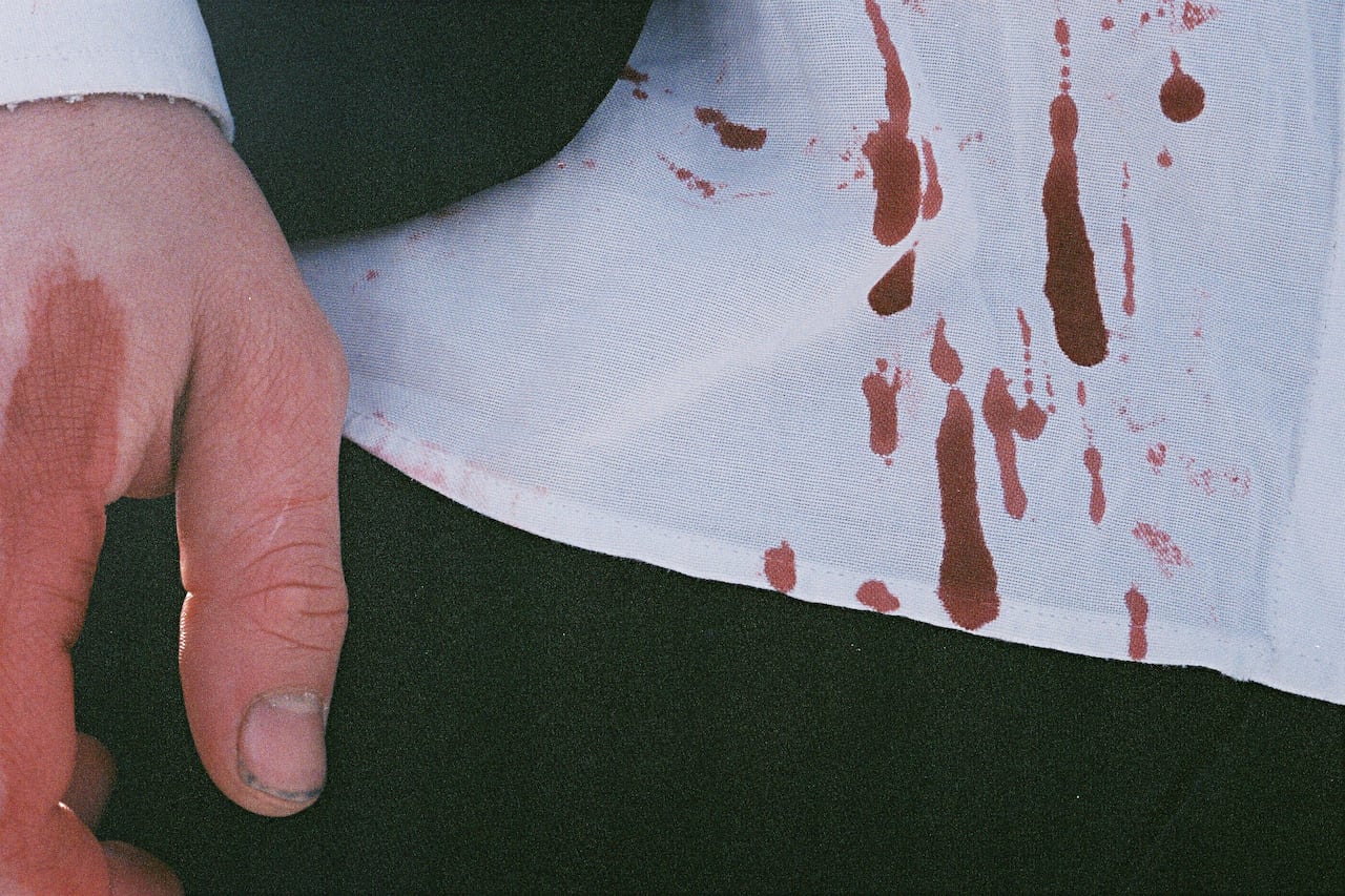 manchas de sangre