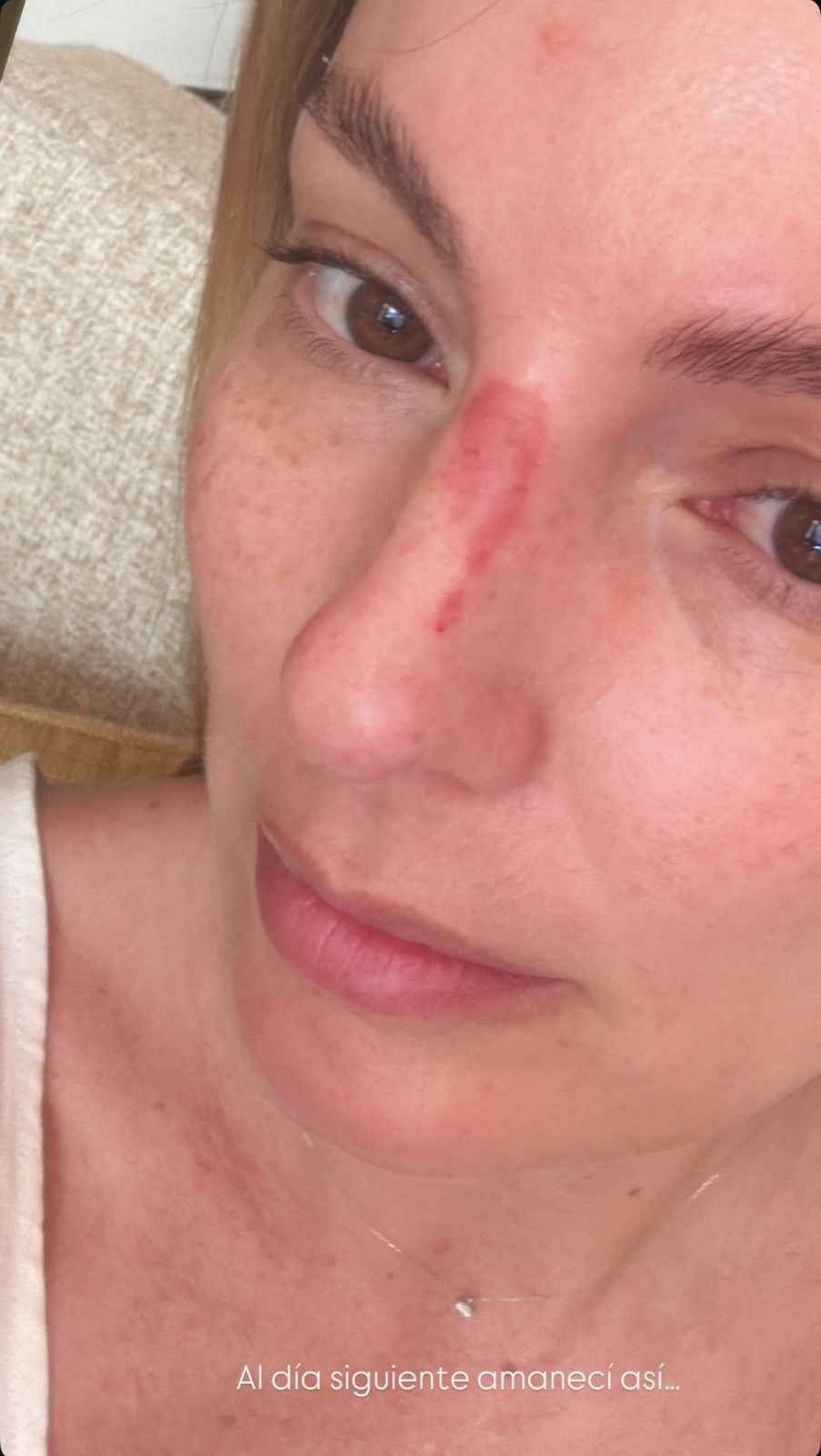 Primeros indicios de lo que pasaba en la nariz de Claudia Bahamón.