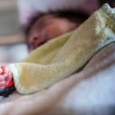 "El oxígeno es útil en muchos casos, desde para el bebé más pequeño que necesita oxígeno hasta alguien con enfermedad pulmonar crónica avanzada en poblaciones de edad avanzada", dice la Greenslade / BBC - GETTY IMAGES