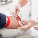 Aproximadamente entre el 5 y 10 % de las personas con prediabetes, de no realizar modificaciones en sus hábitos para tratarla, desarrollarán diabetes. Lo que significa que 7 de cada 10 individuos con prediabetes tendrán diabetes.