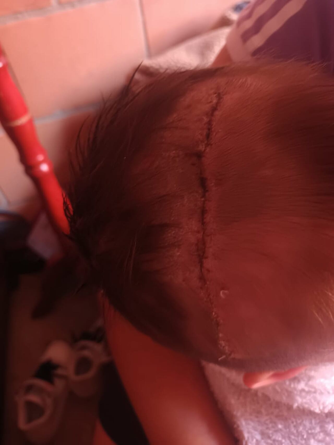 Un hombre atacó, en venganza y con un ladrillo, a un niño de dos años. El menor se encuentra en coma. La Fiscalía capturó al responsable