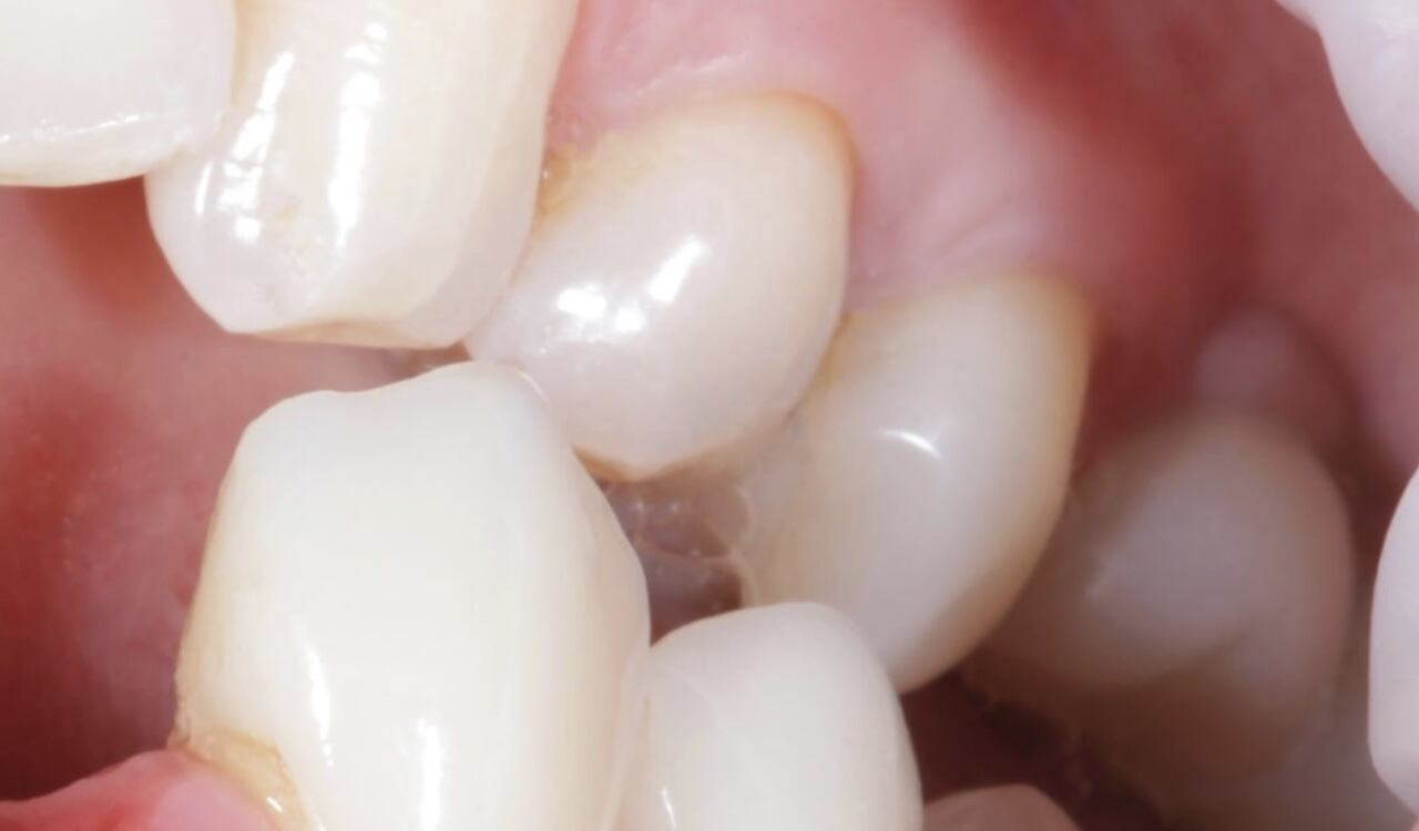 El uso del perejil ayuda a tener una mejor salud bucal