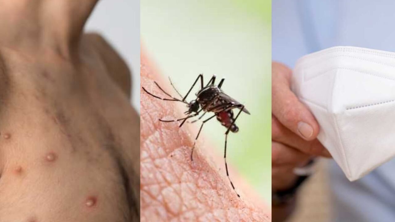 Viruela de mono, dengue y covid