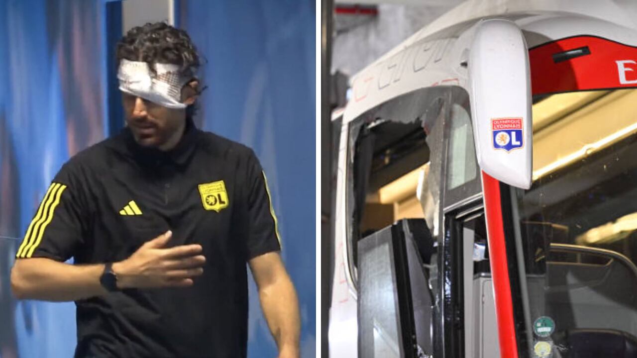 Fabio Grosso sufrió afectaciones en su rostro tras el ataque del bus al Lyon