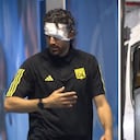 Fabio Grosso sufrió afectaciones en su rostro tras el ataque del bus al Lyon