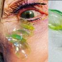 Lentes de contacto, California