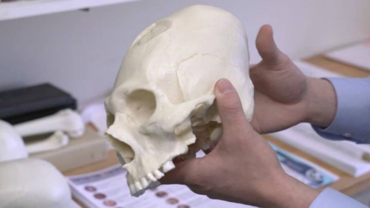 La forma alargada y estrecha de la cabeza fue un rasgo distintivo de lo collaguas