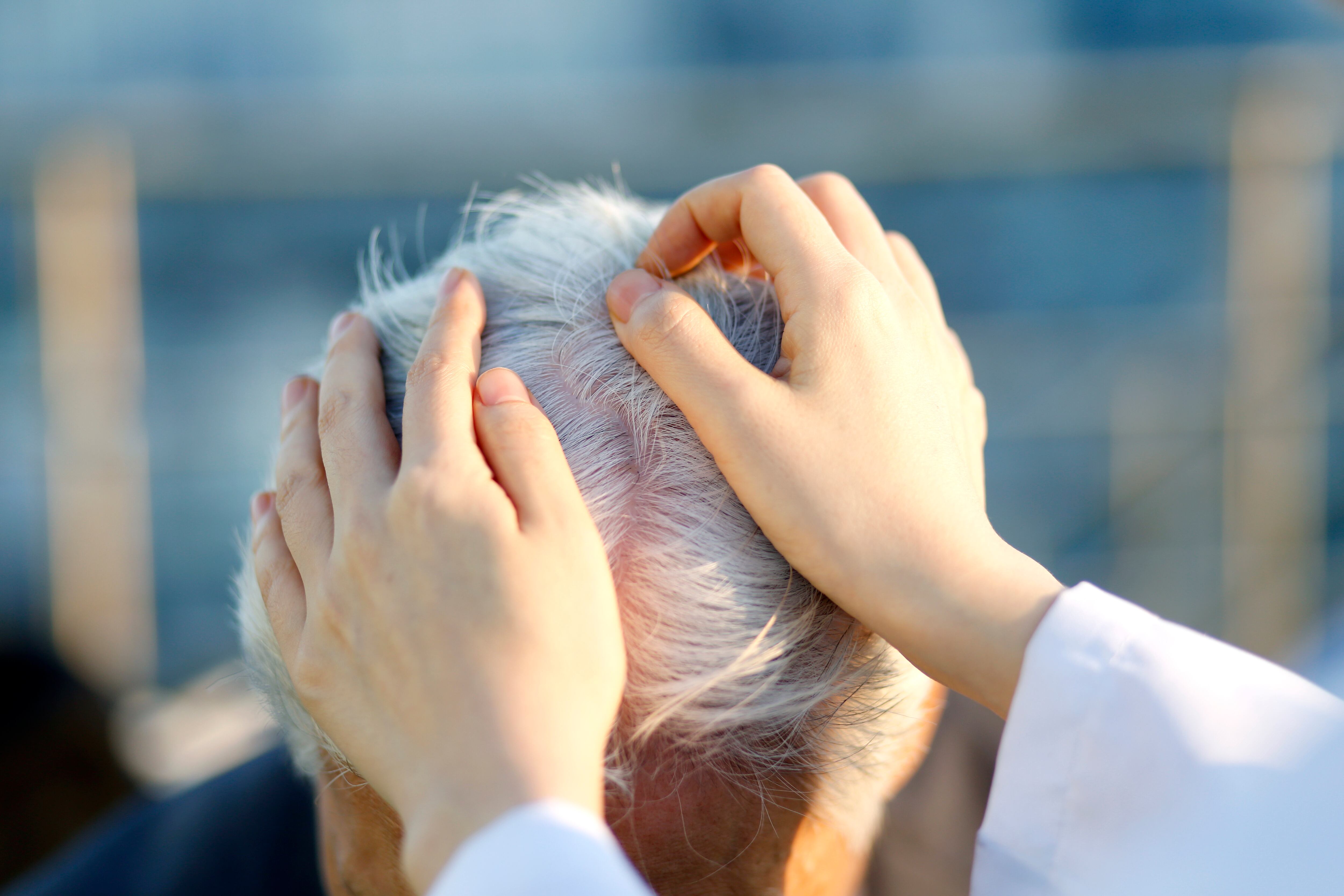 Hay que estar atentos con los lugares donde se aplican implantes capilares