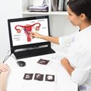 Ginecología, consulta. El ginecólogo explica a una mujer con enfermedades del útero y los ovarios, señalando el útero atómico.