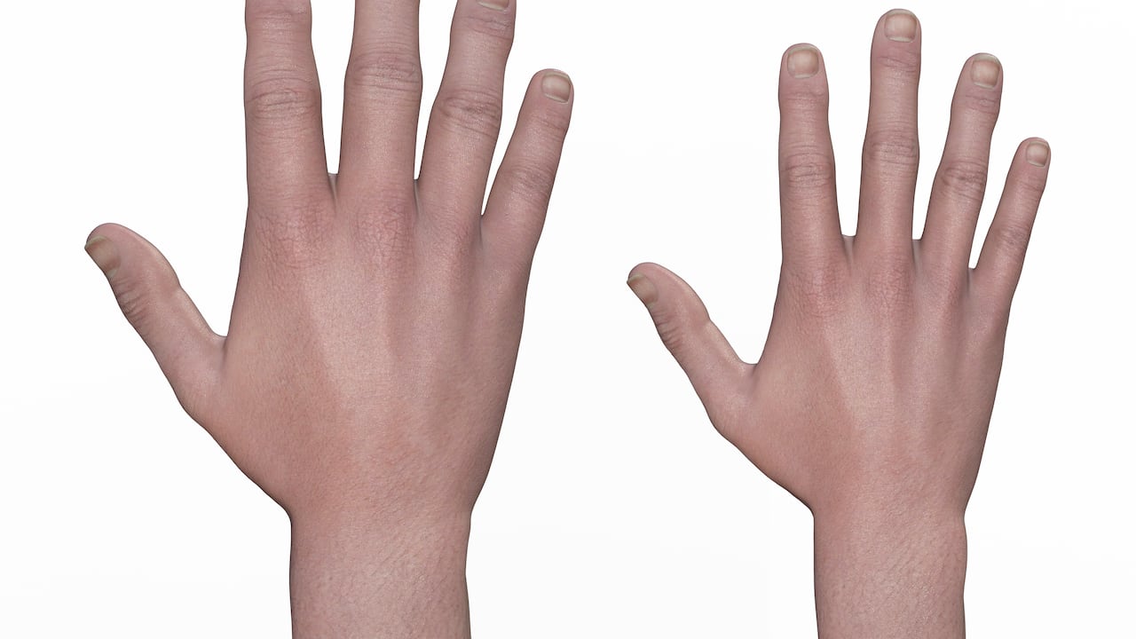 enfermedades raras huérfanas