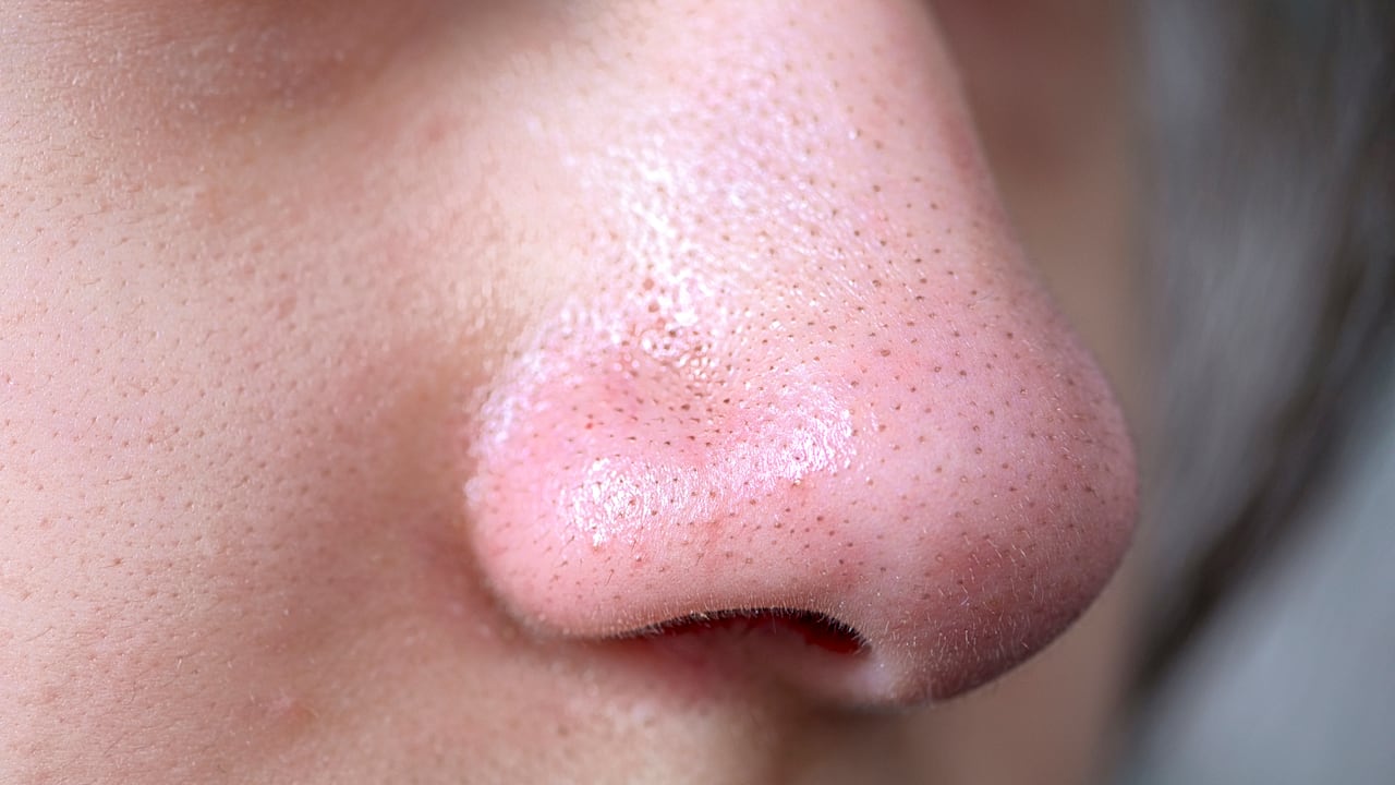 Productos para tratar los puntos negros hay por montones; las farmacéuticas y las empresas de la industria cosmética se encargan de estrenar a menudo nuevas invenciones.