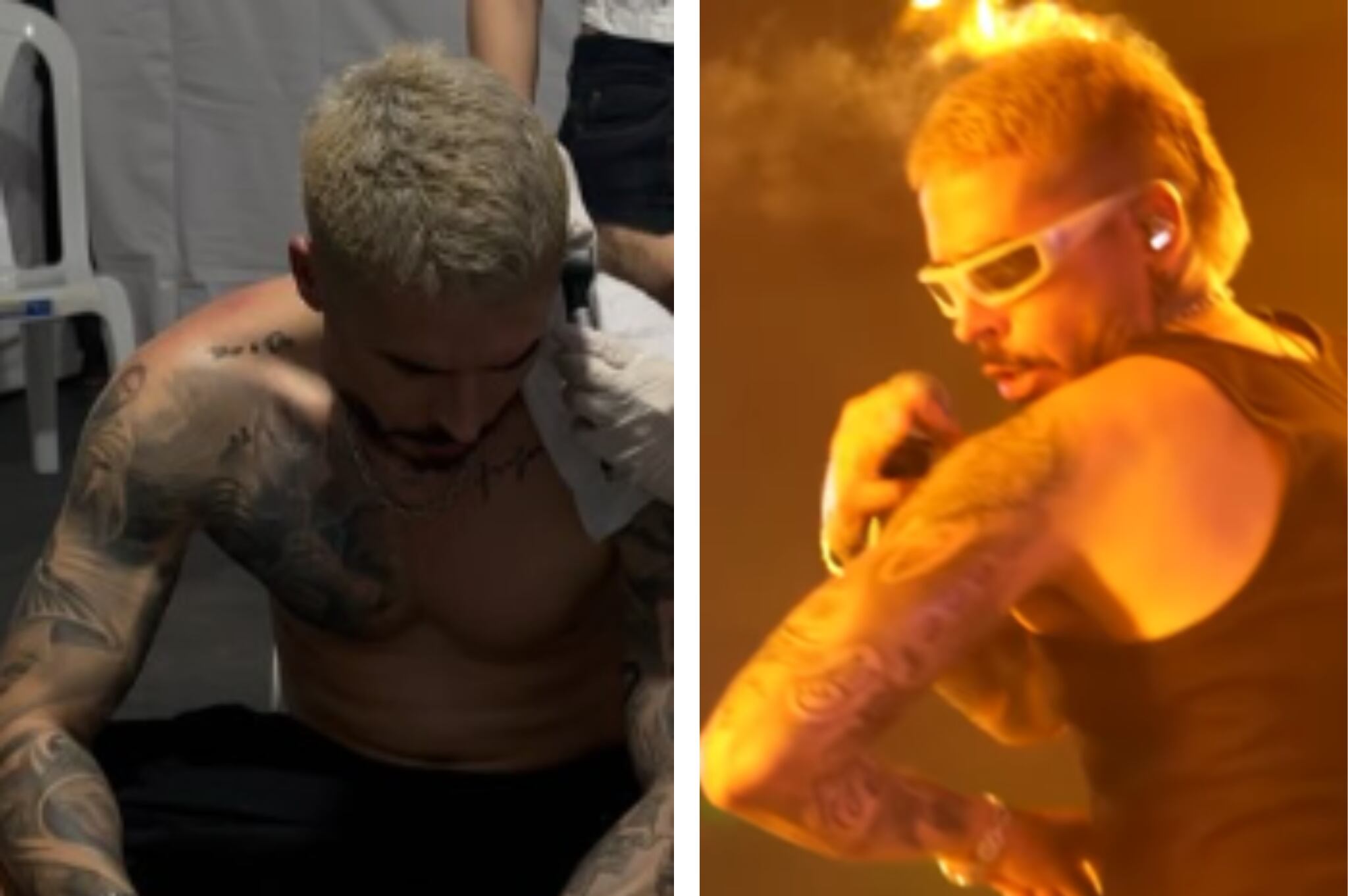 Reykon sufrió incidente con fuego durante su concierto en Neiva.