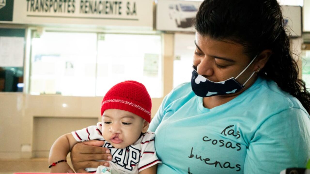 Fundación sonrisa paladar hendido o fisurado