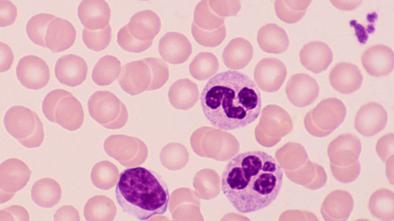 El leucocito de la izquierda con un núcleo ovalado es un linfocito, una importante célula inmunitaria. Los dos leucocitos a la derecha del linfocito son los neutrófilos. Por lo general, tienen un núcleo segmentado o lobulado. Los neutrófilos son excelentes células fagocíticas que engullen partículas o microorganismos dañinos. Los Trombocitos están en la esquina superior derecha, son muy importantes en la trombosis o coagulación de la sangre. Las células teñidas de rosa son eritrocitos, carecen de núcleo, de ahí la palidez central, contienen grandes cantidades de moléculas de hemoglobina y transportan oxígeno. Este es un frotis de sangre normal usando la tinción de Wright.