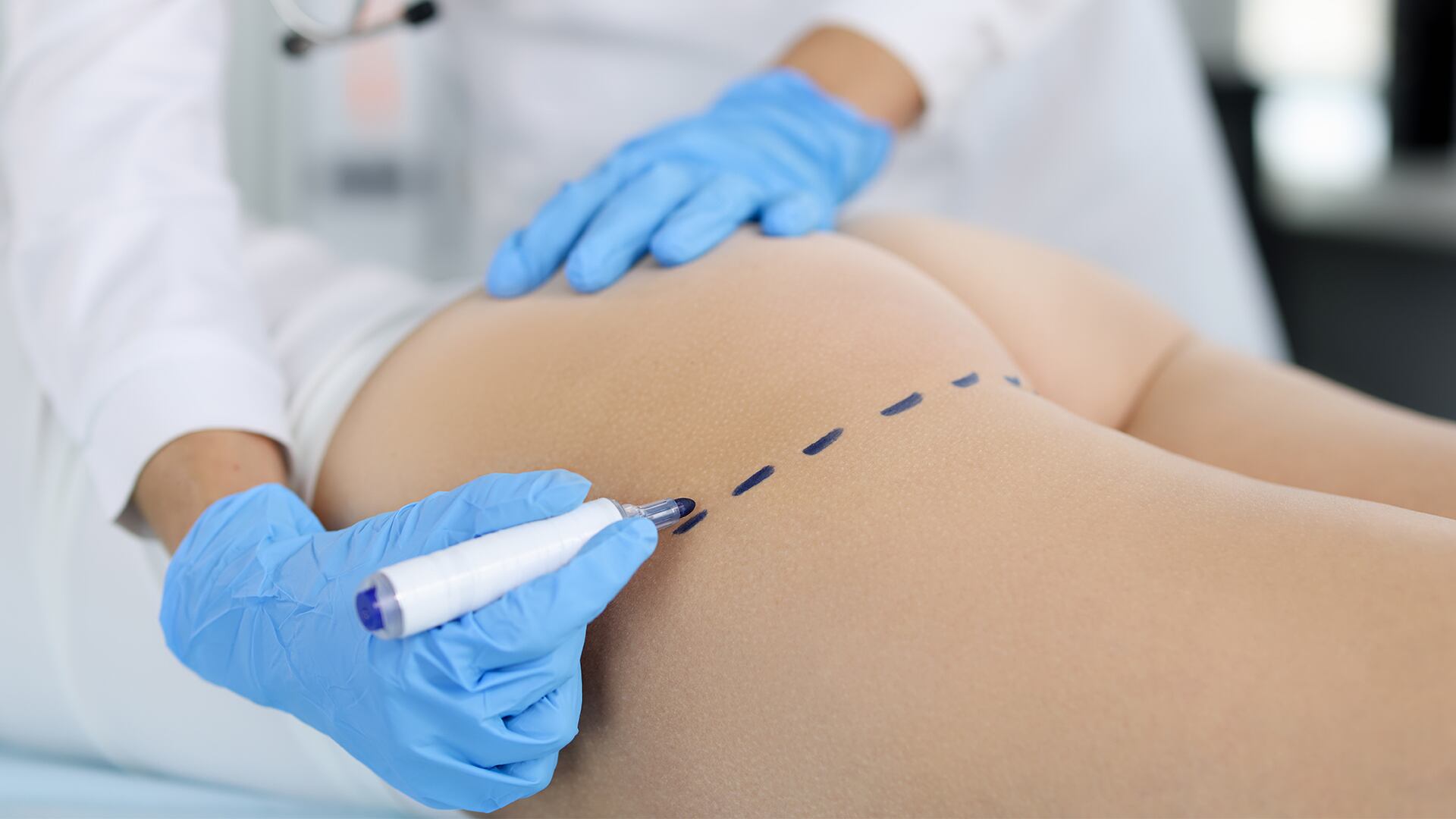 Todos los pacientes deben saber que la cirugía plástica es un procedimiento irreversible.