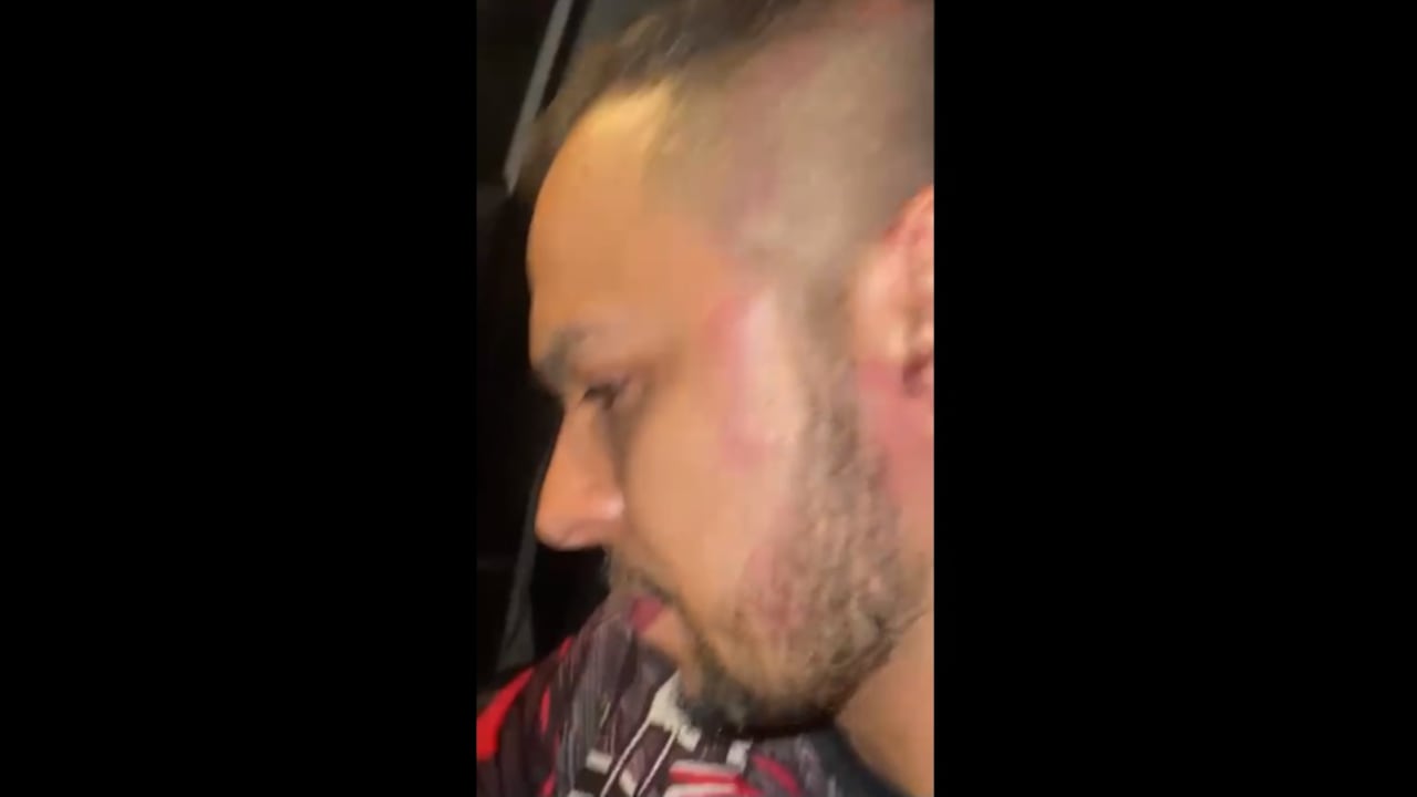 Escobar dijo ser atacado por “sujetos que se identificaron como petristas”.