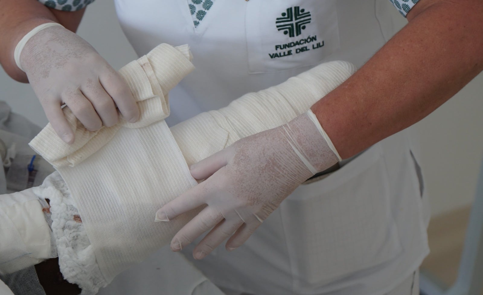 UCI Quemados - Fundación Valle del Lili