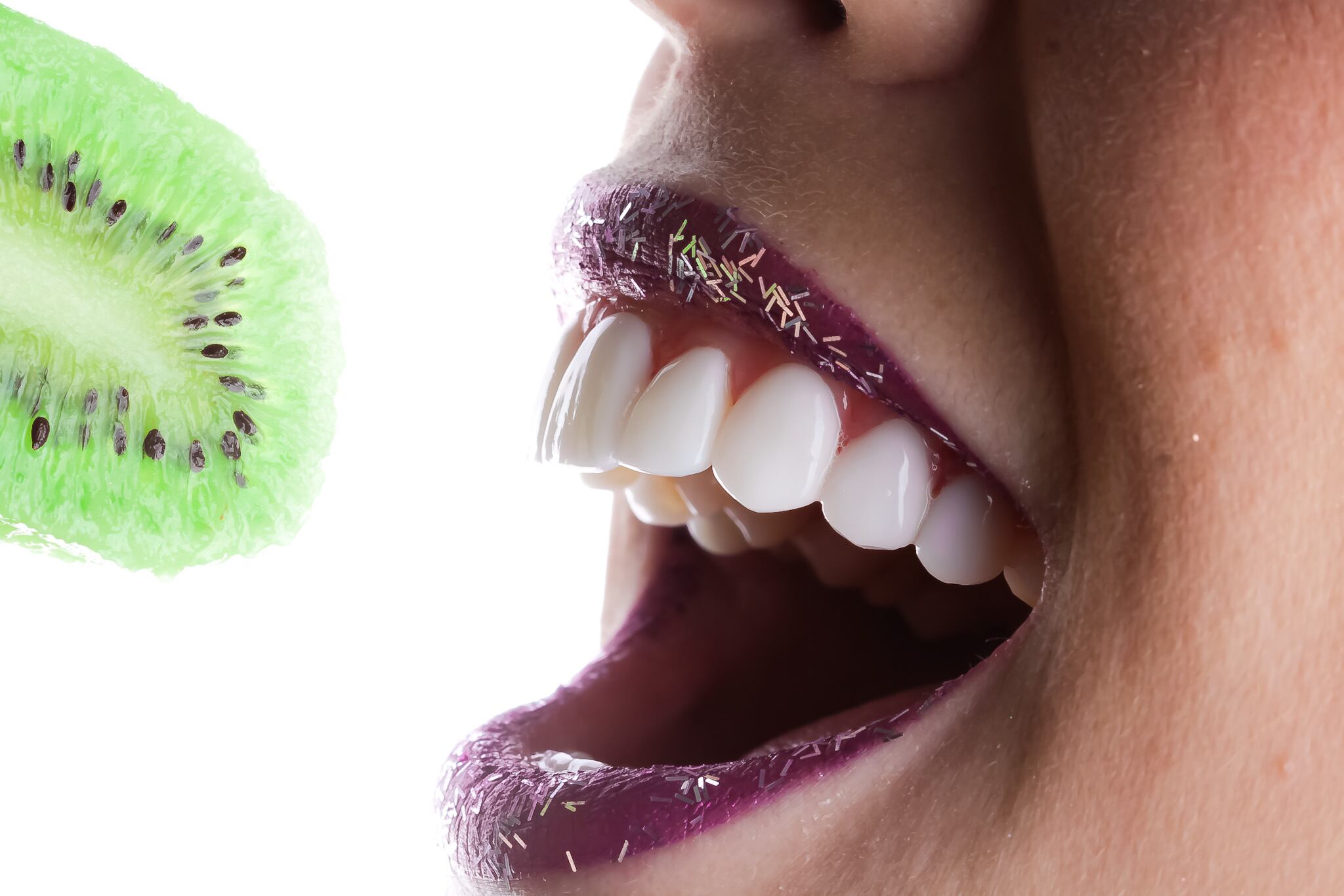 Las carillas dentales mejoran la apariencia de la sonrisa