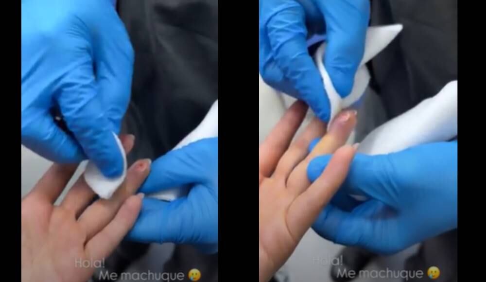 Lina Tejeiro sufrió accidente en viaje.