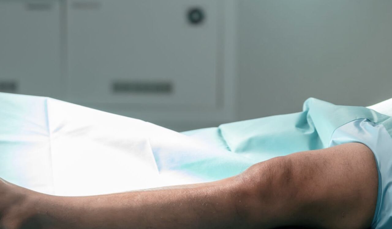 Una de sus piernas tuvo que ser amputada (image de referencia)