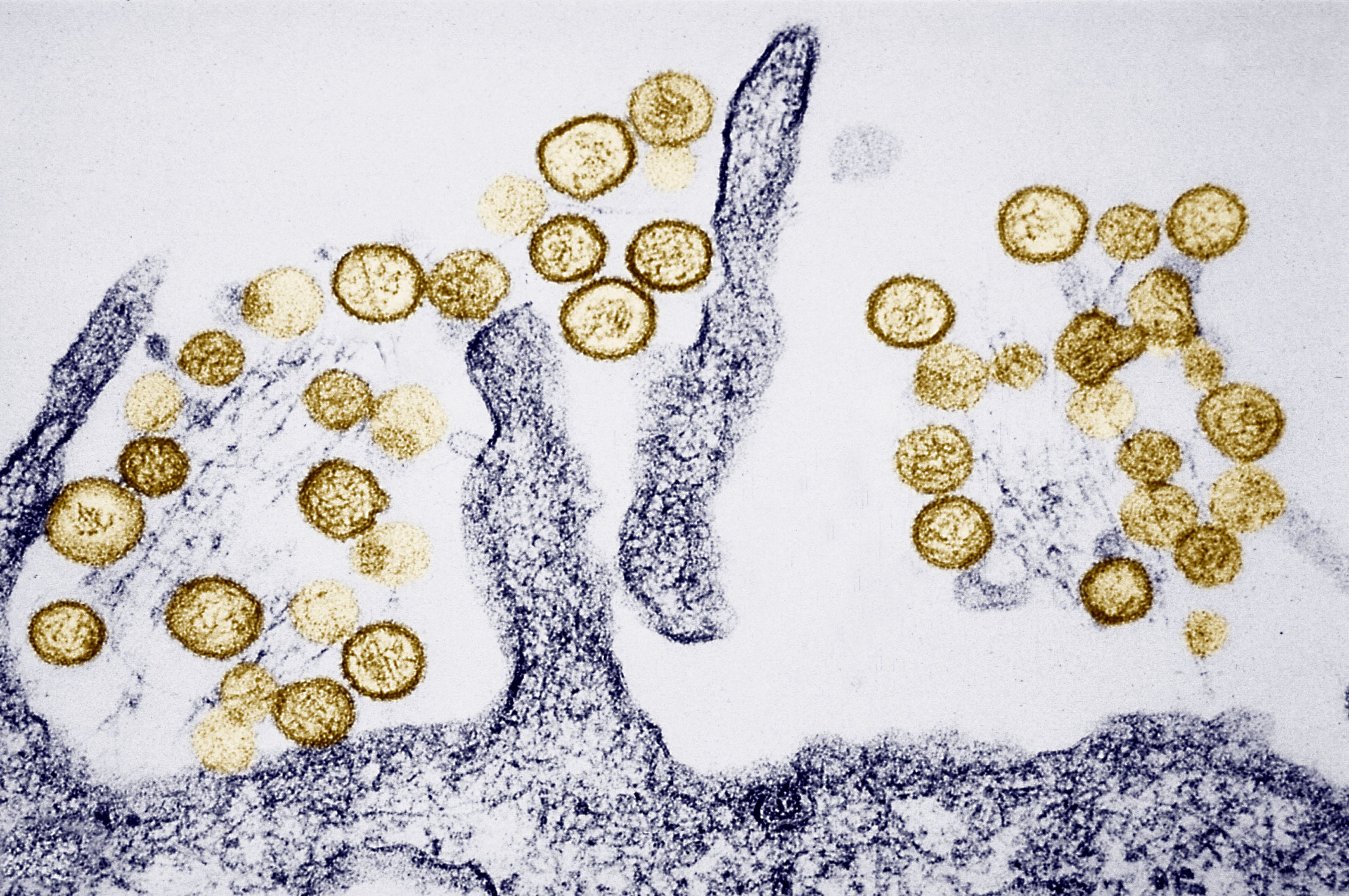 Los hantavirus que causan el síndrome pulmonar por hantavirus (SPH) se transmiten a través de las heces de roedores, especialmente del ratón ciervo.