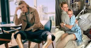 La modelo perdió las dos piernas por la infección.