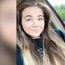 Ashley Zambelli , mujer diagnosticada con síndrome de Down a los 23 años. D