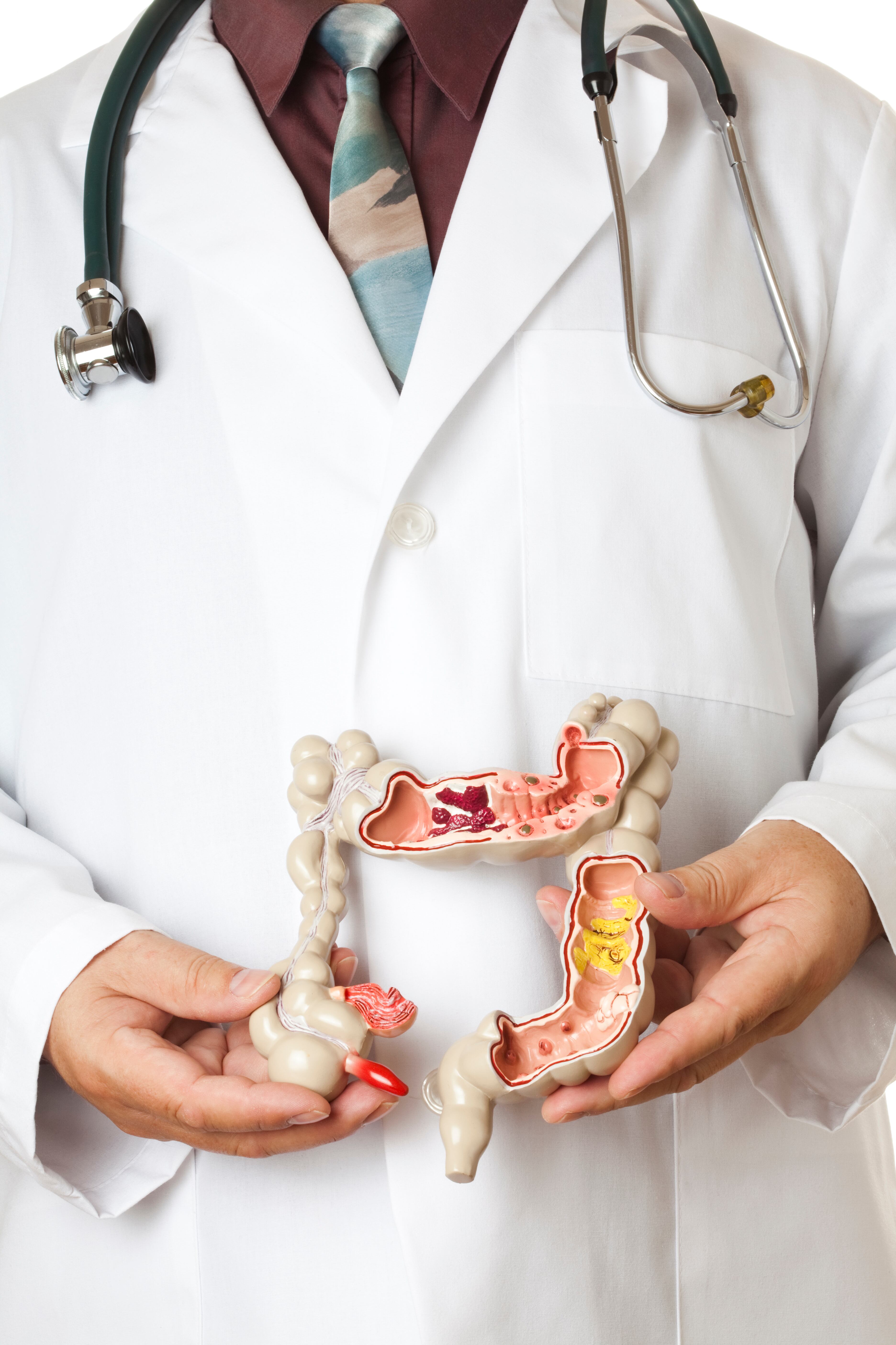 Comer fibra y evitar el gluten, son algunas recomendaciones para evitar el síndrome de intestino irritable. Foto: GettyImages.