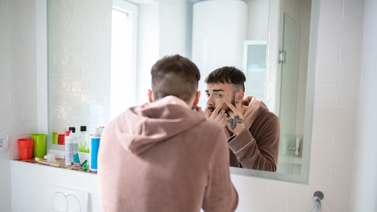 Cualquier persona puede padecer de acné.