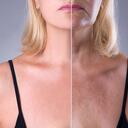 La aplicación de protector solar es indispensable para evitar la aparición de arrugas.