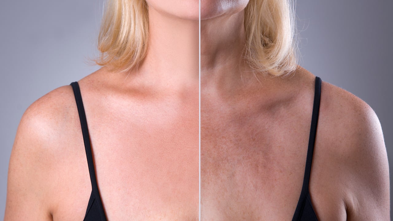 La aplicación de protector solar es indispensable para evitar la aparición de arrugas.