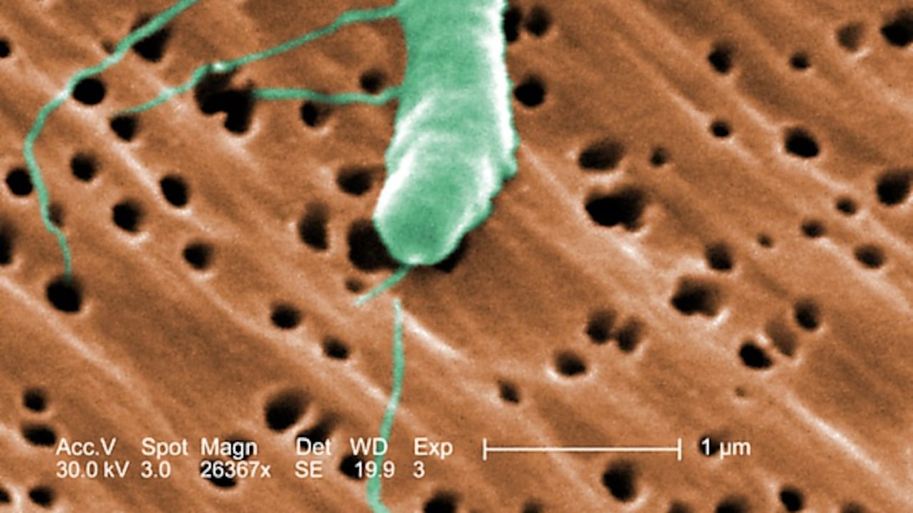 Bacteria Vibrio vulnificus flagelada revelada en la imagen de microscopio electrónico de barrido (MEB) con aumento de 26367x, 2005.