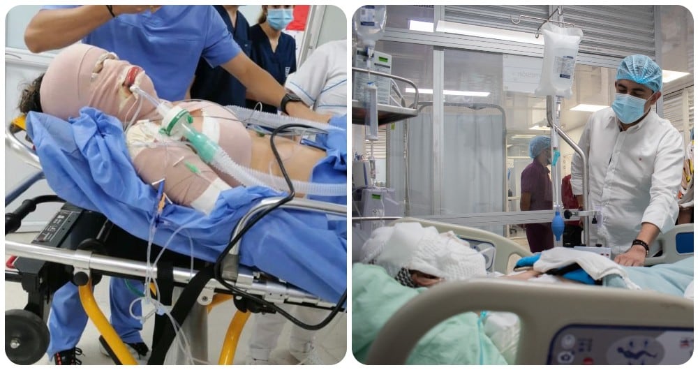 El registrador Alexander Vega, estuvo visitando las funcionarias heridas por el incendio provocado en la sede de Gamarra (Cesar).