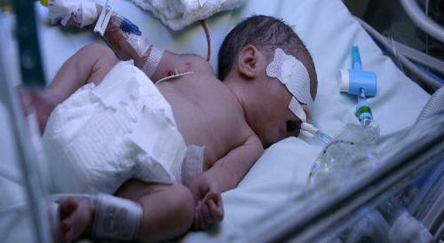 Algunos bebés pueden nacer con fetos alojados en su cuerpo sin que los profesionales médicos lo noten. (Imagen de referencia).