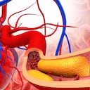 En las arterias se puede acumular placa, también conocido como colesterol. Foto: Getty Images.