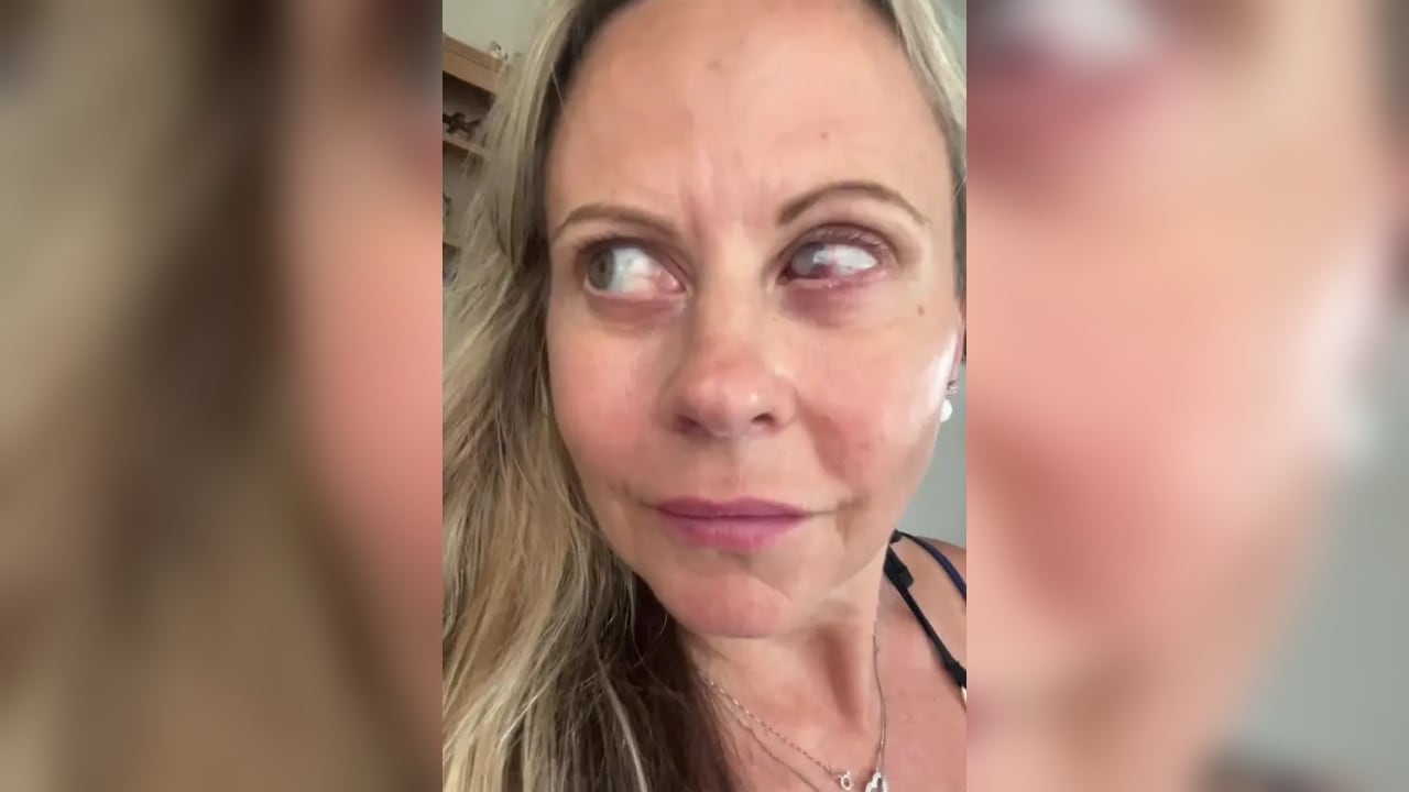 La mujer tuvo que estar varios días en completa oscuridad.