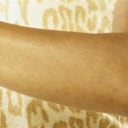 cuidado de los codos