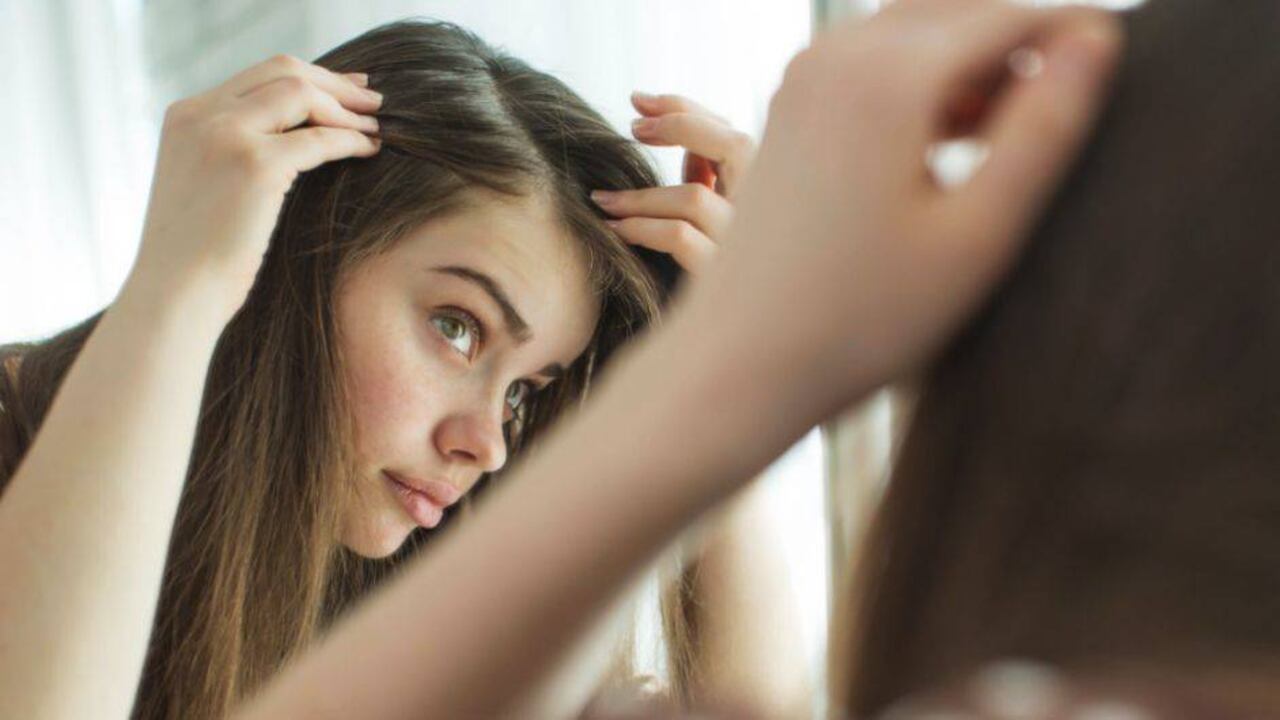 Caspa en el cabello