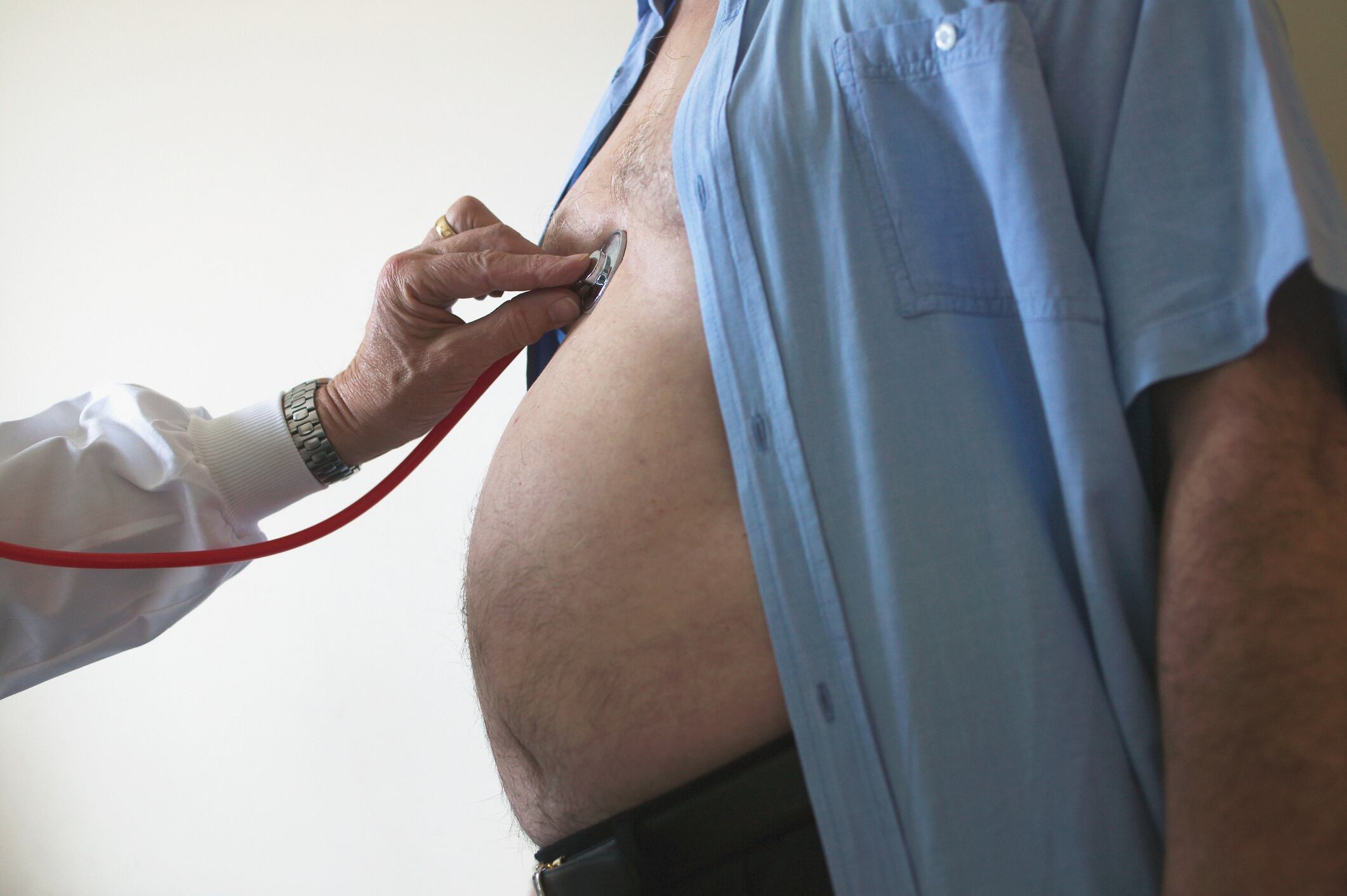 Foto de referencia sobre la obesidad