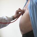 Foto de referencia sobre la obesidad