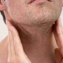 Alimentarse bien y hacer ejercicio pueden contribuir a que el organismo asimile mejor el tratamiento del linfoma.