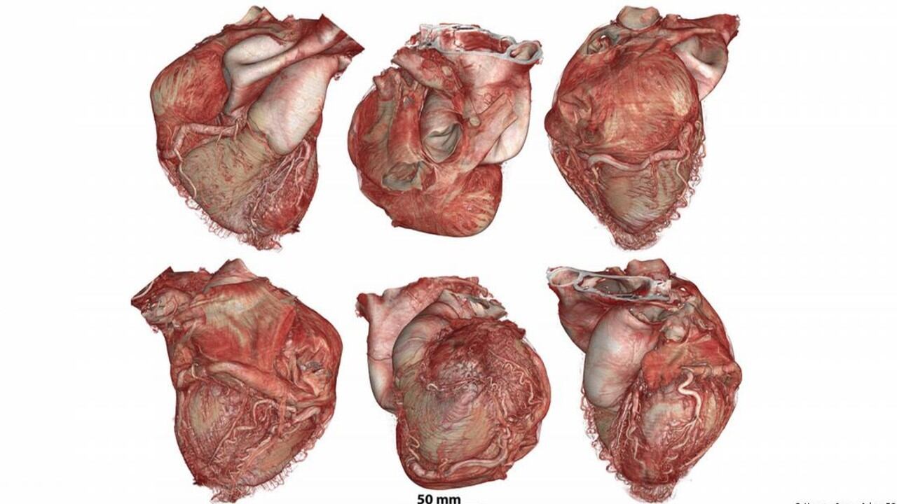 El Atlas de Órganos Humanos capturó el corazón humano desde múltiples perspectivas, revelando su arquitectura interna con una precisión sin precedentes.