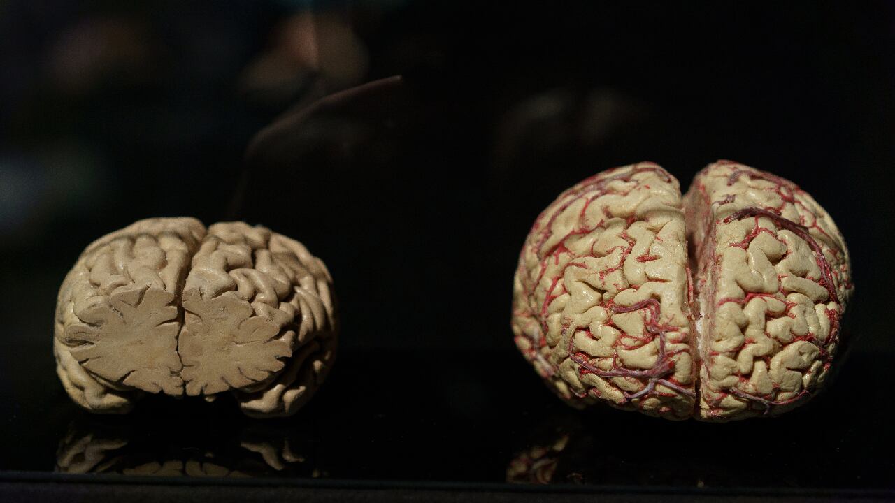 Alimentación balanceada y ejercicio , recomiendan expertos de la Clínica Mayo para evitar el Alzheimer. Foto Getty.