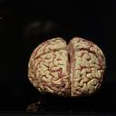 Alimentación balanceada y ejercicio , recomiendan expertos de la Clínica Mayo para evitar el Alzheimer. Foto Getty.