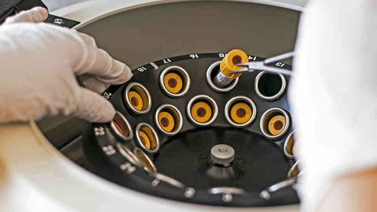 Laboratorios Abbott entregarán más de un millón de pruebas de covid-19 para Colombia